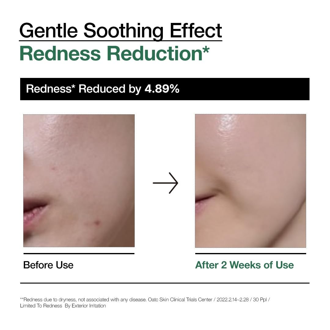 K-Beauty serums on Amazon for glass skin and hydration